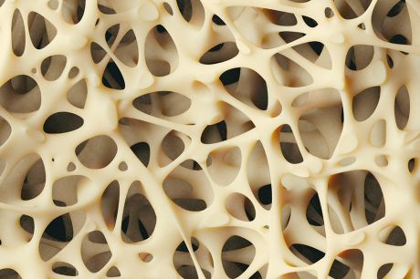 Osteoporoza – jak radzić sobie z narastającym problemem?